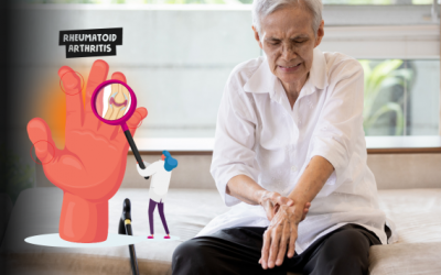 Biến chứng nguy hiểm của bệnh viêm khớp dạng thấp và cách phòng ngừa