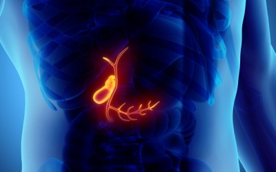 Sỏi mật tái phát sau cắt túi mật nên xử trí thế nào?