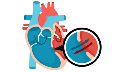 Thông liên nhĩ thứ phát có nguy hiểm không, điều trị thế nào?