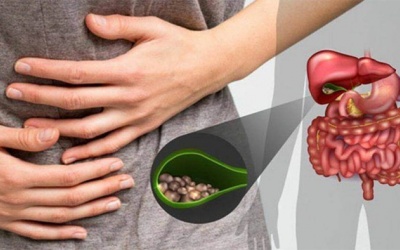 Tái phát sỏi gan 7mm sau cắt túi mật phải làm sao?