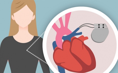 Đặt máy khử rung tim: Rủi ro và cách phòng tránh