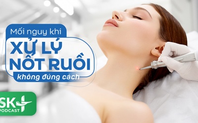 Podcast: Mối nguy khi xử lý nốt ruồi không đúng cách