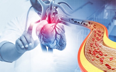 Đặt stent xong có khỏi hoàn toàn bệnh mạch vành không?