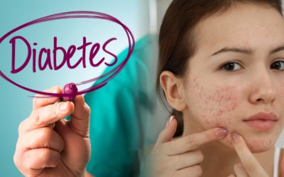 Mối liên hệ giữa dậy thì sớm và bệnh đái tháo đường type 2 ở nữ giới