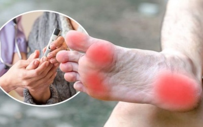Tê bì, châm chích chân tay: Cẩn thận biến chứng đái tháo đường!
