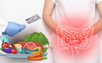 Những thực phẩm khiến bạn bị táo bón