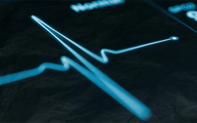 Block nhánh trái cần điều trị như thế nào?