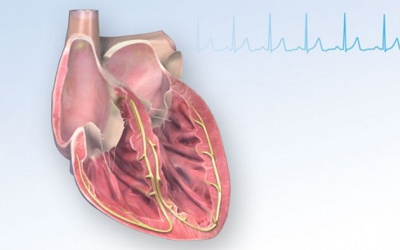 Điều trị block nhánh phải bằng phương pháp nào hiệu quả?