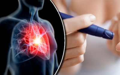 Điều trị thế nào khi bị thiếu máu cơ tim do bệnh đái tháo đường?