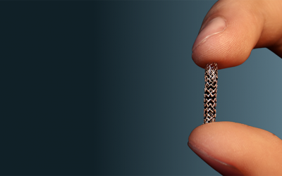 Đau tức ngực, hẹp mạch vành 50 - 60% đã đặt stent được chưa?