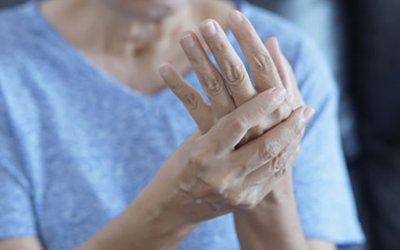 Viêm khớp dạng thấp tái phát mùa nồm ẩm phải làm sao?