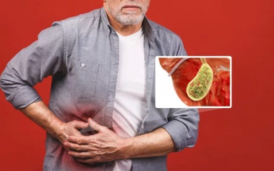 Có cách nào xử trí sỏi túi mật mà không phẫu thuật?