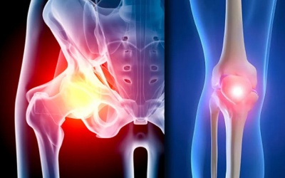 Y tế tuần: Kỹ thuật thay khớp giúp người bệnh thoát khỏi nguy cơ tàn phế