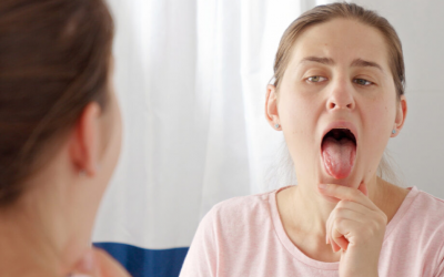 Các triệu chứng viêm amidan đáy lưỡi và cách đối phó hiệu quả