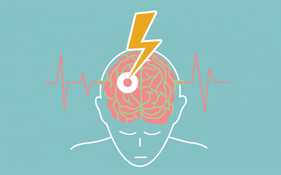 Biện pháp phòng ngừa nguy cơ đột quỵ theo độ tuổi