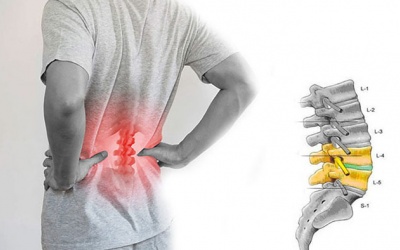 Bệnh gai đốt sống lưng: Nguyên nhân và cách cải thiện
