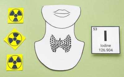 3 phương pháp điều trị bệnh Basedow phổ biến hiện nay