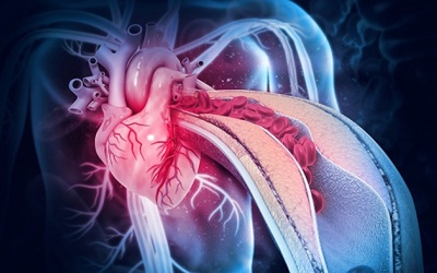 Chi phí bắc cầu động mạch vành hết bao nhiêu tiền?