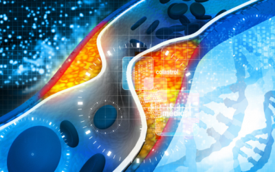 Mỡ máu cao - Sát thủ âm thầm gây nhồi máu cơ tim