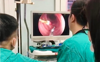 Nội soi gắp kim diệt tủy răng trong bụng bé trai 8 tuổi tại Thái Nguyên