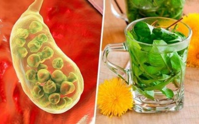 Cách đẩy sỏi mật ra ngoài từ mẹo dân gian liệu có hiệu quả?