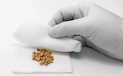 Sỏi mật 8,5mm không triệu chứng có nguy hiểm không?