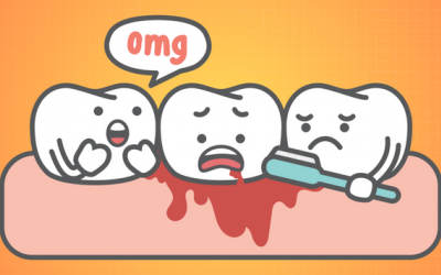 5 lý do dẫn đến chảy máu chân răng