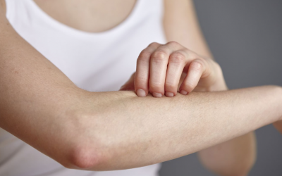 Những lưu ý giúp nâng cao hiệu quả điều trị đau sau zona thần kinh