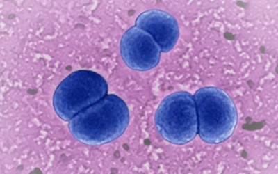 CDC Mỹ cảnh báo về vi khuẩn gây bệnh viêm não mô cầu hiếm gặp