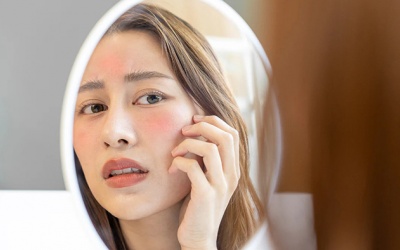 Biện pháp phục hồi hàng rào bảo vệ da đón Hè