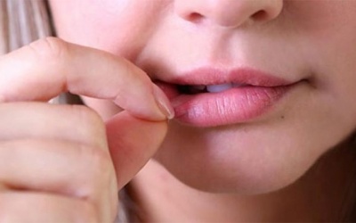 Cẩn trọng với thói quen bóc da môi 