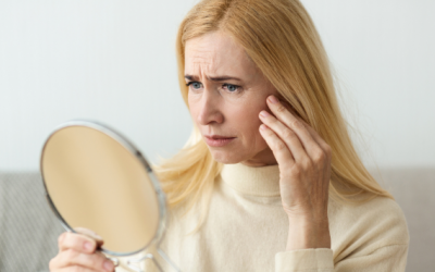 10 mẹo để loại bỏ nếp nhăn biểu cảm