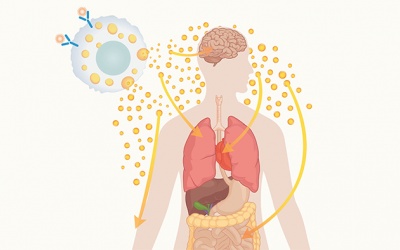 Hội chứng hiếm gặp khiến người phụ nữ dị ứng nặng với thực phẩm  
