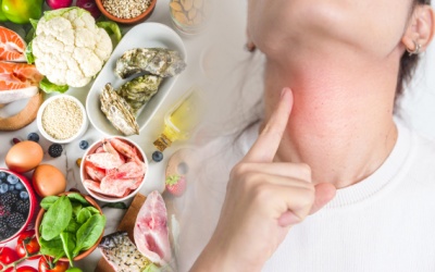 Người mắc u tuyến giáp nên ăn gì để cải thiện bệnh hiệu quả?