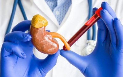 Chỉ số creatinin tăng có phải bị biến chứng thận đái tháo đường không?