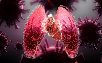 Ung thư phổi giai đoạn 3 sống được bao lâu?