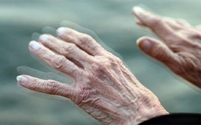 Run do bệnh Parkinson có nguy hiểm không?