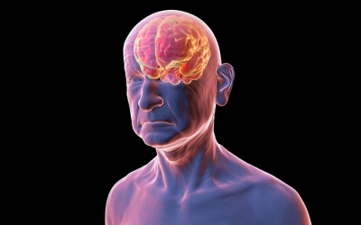 Đột phá: Xét nghiệm máu giúp dự đoán trước nguy cơ đột quỵ