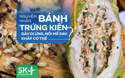 Podcast: Nguyên nhân bánh trứng kiến gây dị ứng, nổi mề đay khắp cơ thể? 