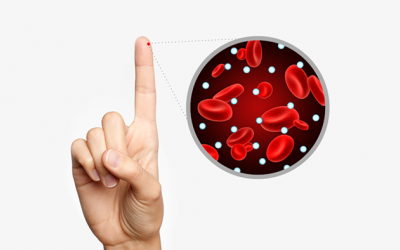 Bạn có thể làm gì để “đảo ngược” tình trạng kháng insulin?