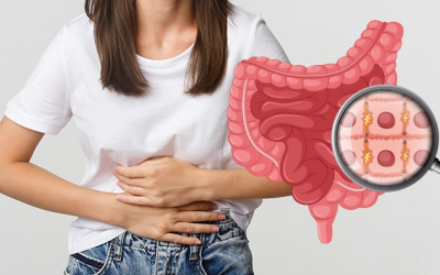 Ung thư đại trực tràng đang gia tăng ở trẻ em và thanh thiếu niên