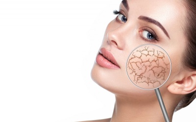 5 loại thực phẩm có thể là nguyên nhân gây khô da