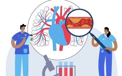 Triglyceride tăng cao gây ra biến chứng nào?