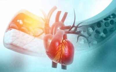 Phải làm sao khi bị biến chứng thiếu máu cơ tim do đái tháo đường?