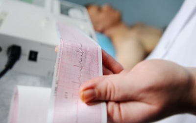 Hội chứng tái cực sớm có nguy hiểm không?