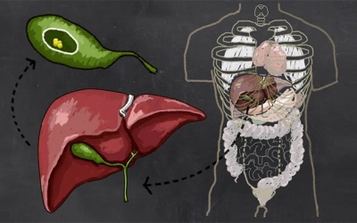 Người bệnh chia sẻ bí quyết giúp tan sỏi đường mật trong gan