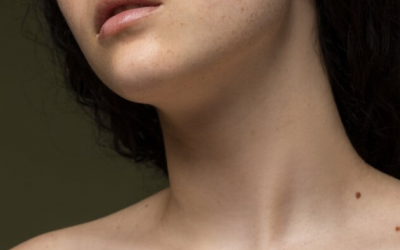 Tránh nhầm lẫn giữa nốt ruồi và mụn thịt dư 