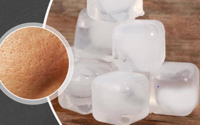 Chườm đá lên da có giúp thu nhỏ lỗ chân lông?