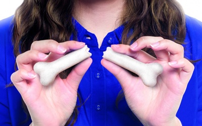 Những điều phụ nữ nên tránh để phòng ngừa loãng xương