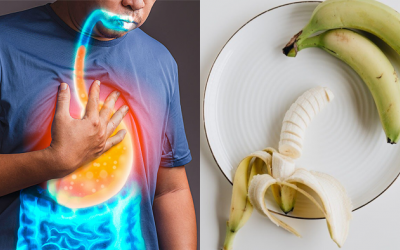 Trào ngược dạ dày thực quản có nên ăn chuối không?